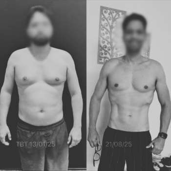 Antes-x-Depois-Dr.-Bruno-1.png