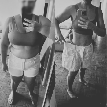 Antes-x-Depois-Dr.-Bruno-2.png